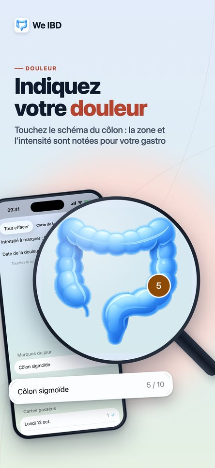 Indiquez votre douleur. Touchez le schéma du côlon : la zone et l’intensité sont notées pour votre gastro.