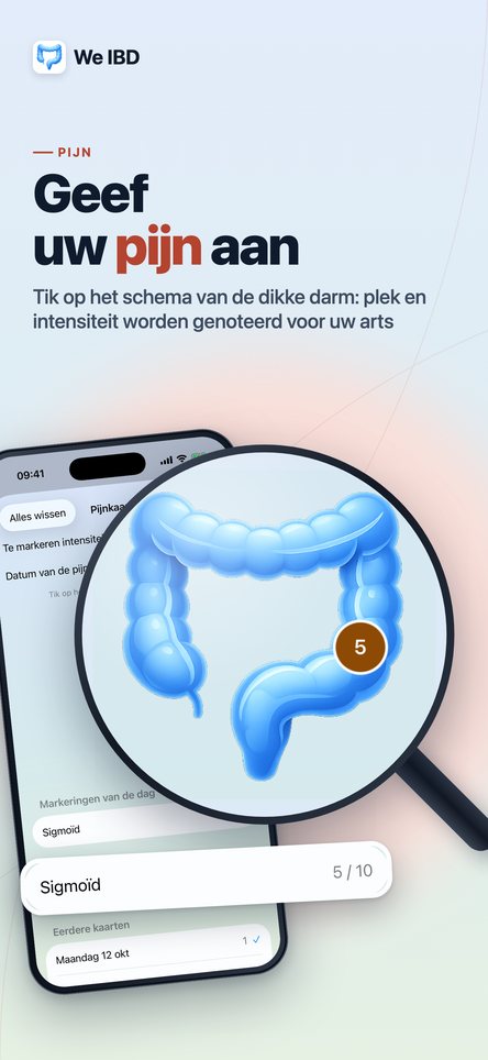 Geef uw pijn aan. Tik op het schema van de dikke darm: plek en intensiteit worden genoteerd voor uw arts.